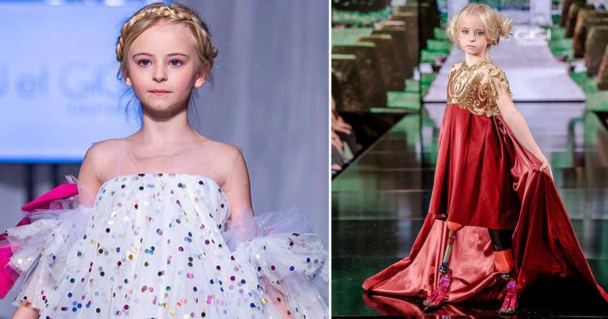 double amputee daisy.jpg?resize=412,275 - Seven-Year-Old Double Amputee Doesn’t Let Her Disability Affect Her