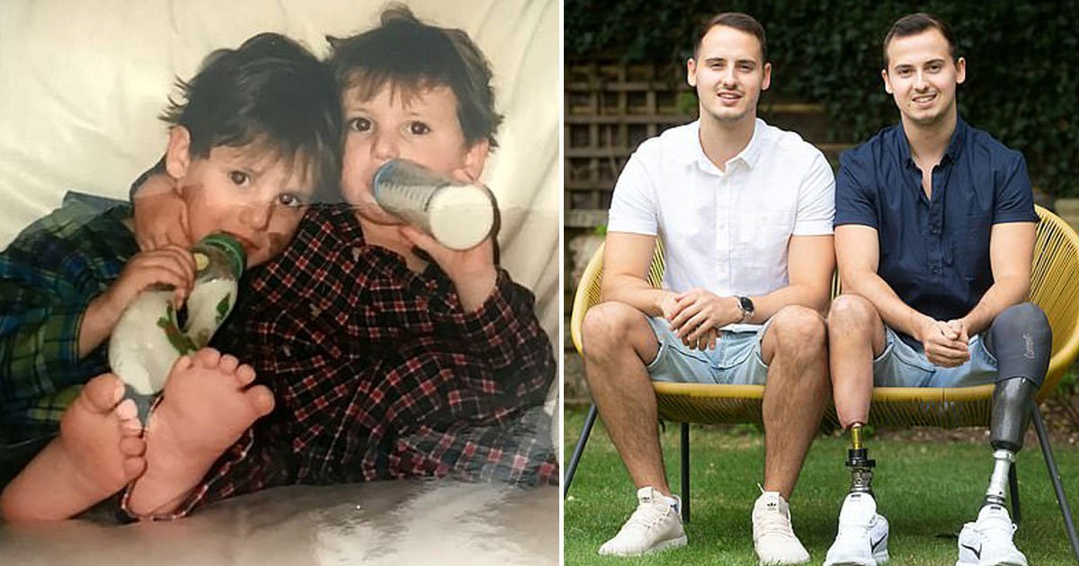 man amputated paid 6000.jpg?resize=412,275 - Reality TV Star Paid £64,000 To Have His Leg Amputated After Experiencing Constant Pain Due To His Rare Condition