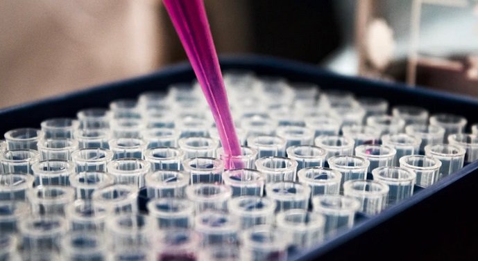 russie labo.jpg?resize=1200,630 - En Russie, un laboratoire renfermant la variole et le virus Ebola a explosé