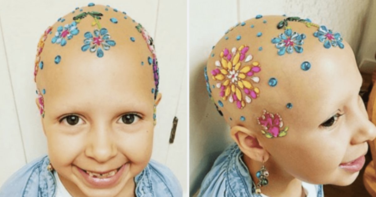 s4 8.png?resize=1200,630 - Une petite fille atteinte d'alopécie a prouvé qu'une maladie ne pouvait pas vous empêcher de vivre