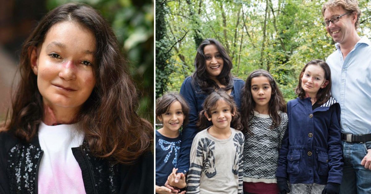 sohana collins.jpg?resize=412,275 - Teenager With Butterfly Skin Helped Raise Over £5 Million For EB Research