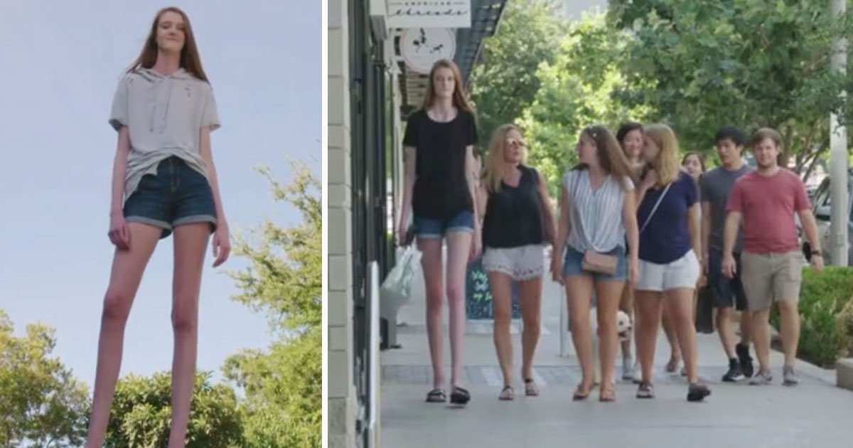 tallest girl.jpg?resize=1200,630 - Teenager - Who Has The World’s Longest Legs - Aspires To Become A Model