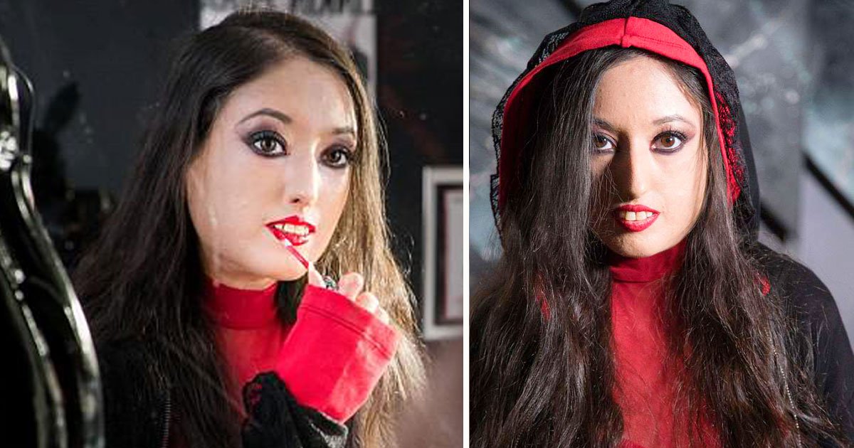 tragic doll woman.jpg?resize=412,275 - Woman Has Turned Into A ‘Doll' Due To A Rare Condition