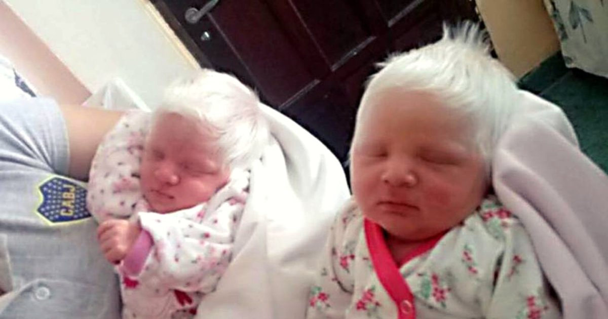 twins5.png?resize=1200,630 - Des jumelles spéciales : Elles sont nées avec les cheveux blancs