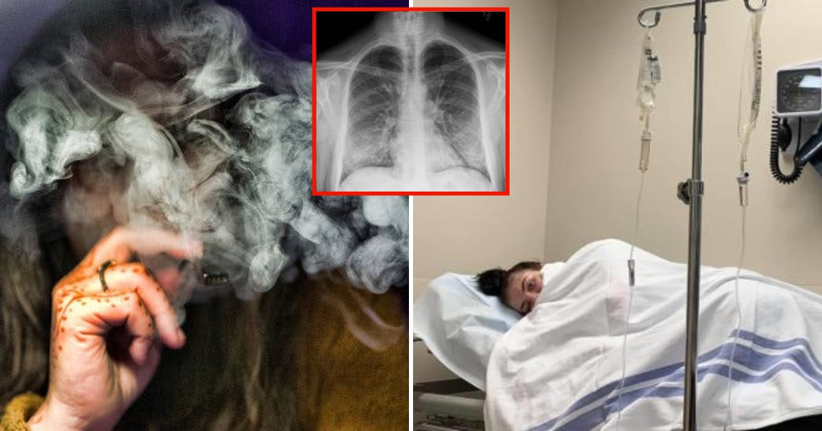 vaping5.png?resize=1200,630 - Serious Warning Issued After Fifth Person Passed Away From Mysterious Lung Illness Linked To Vaping
