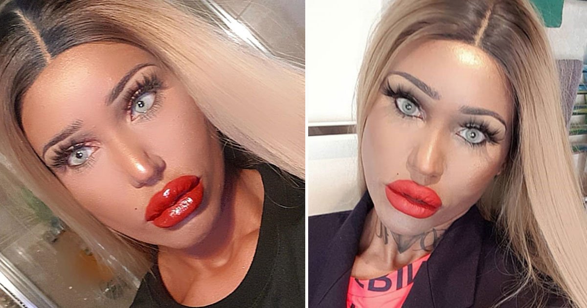 Mother Who Looks Like A BlowUp Doll Says Her Children Are Proud Of
