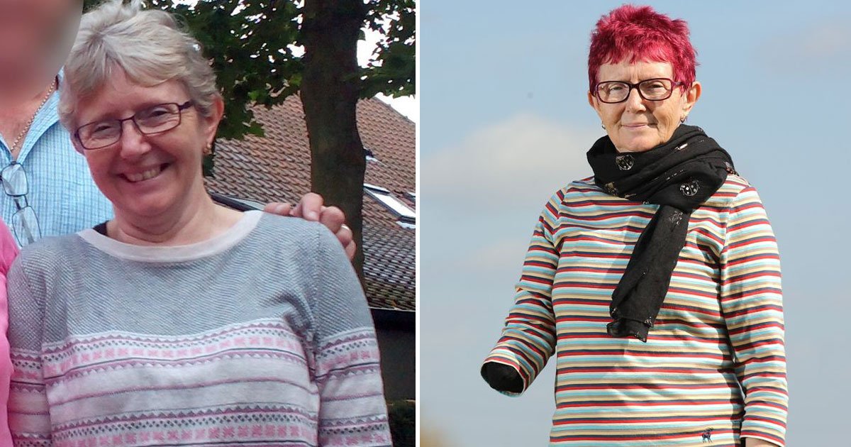 woman lost hand dog attack.jpg?resize=412,275 - 90kg Dog Ripped Off A Woman’s Right Hand When She Was Cleaning Its Kennel