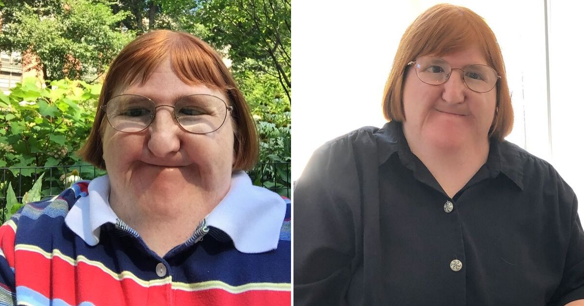 blake6.png?resize=412,275 - Writer With Disability Was Told She's 'Too Ugly' On Twitter So She Fights Back With 3 Beautiful Selfies