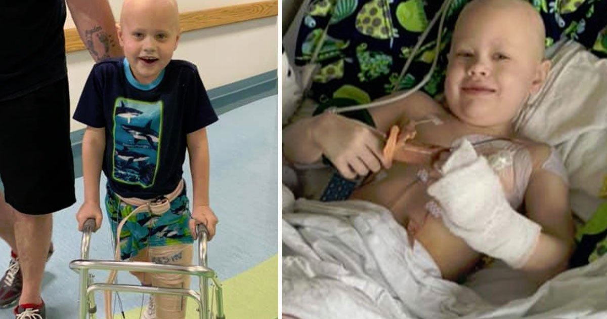 boy survived cancer lost leg.jpg?resize=1200,630 - Seven-Year-Old Boy - Who Survived Cancer But Lost His Leg - Will Be Able To Walk Again