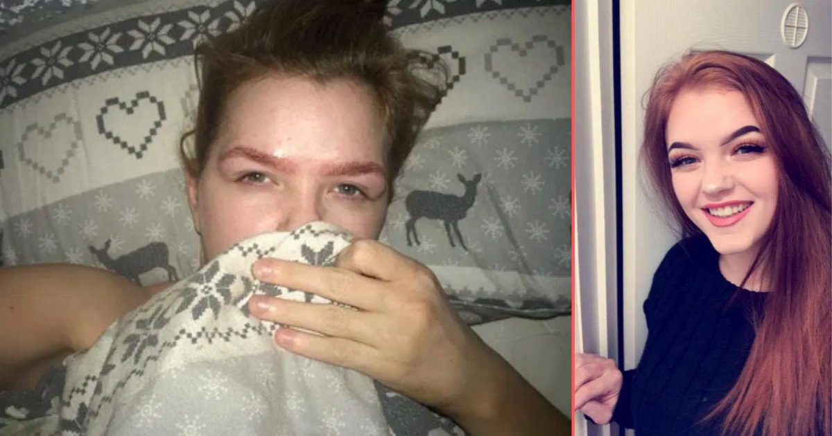 d 4 2.png?resize=1200,630 - At-Home Tint Kit Leaves Student’s Eyebrows Burnt and She Gets Hospitalized