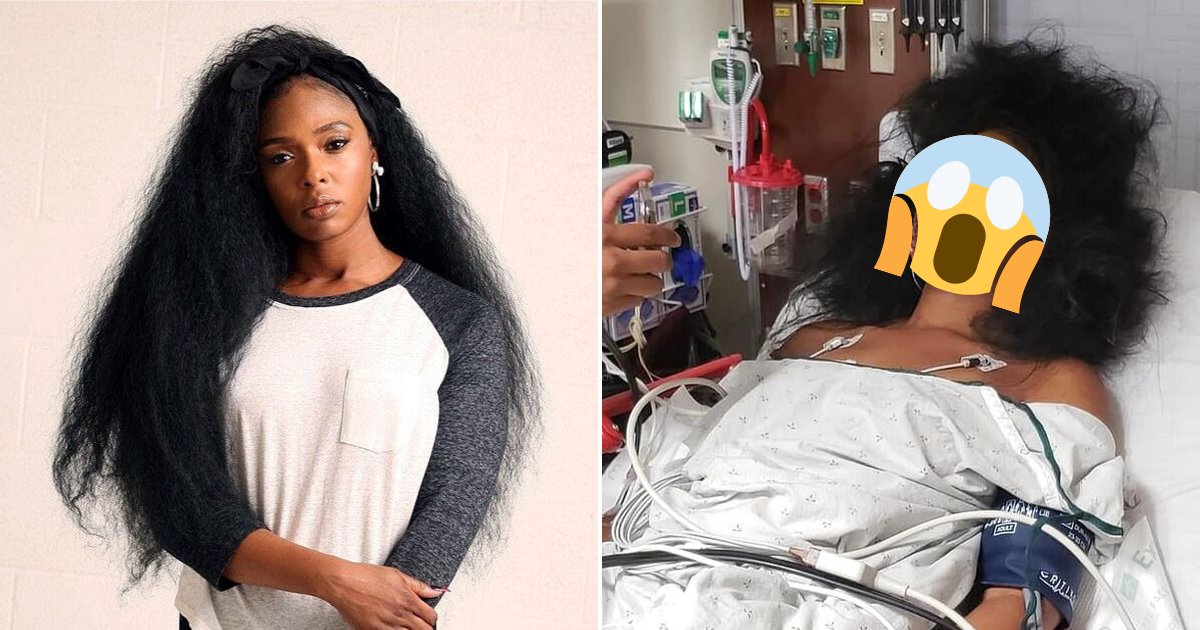 makeup4.png?resize=412,275 - Woman's Make-Up Created HUGE Scare At Hospital After Doctors Thought She Had Severe Facial Wounds