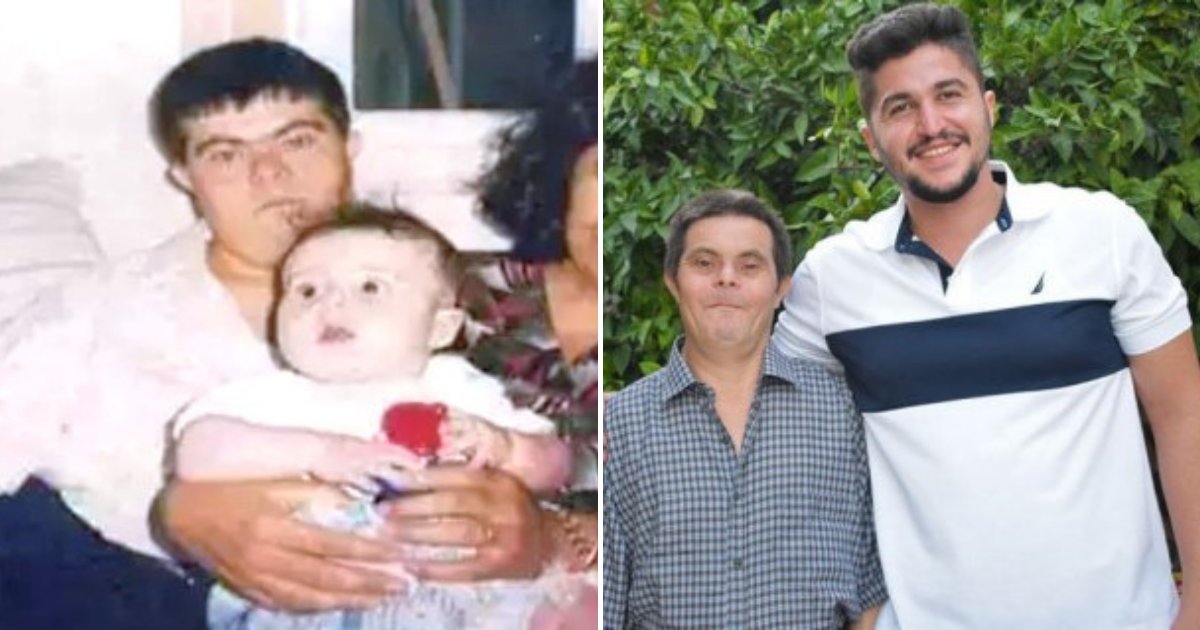sadar5.png?resize=412,275 - Man Shared How It's Like To Be Raised By A Father With Down's Syndrome