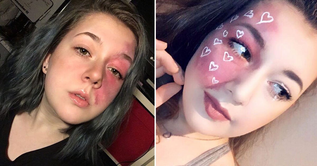student highlights birthmark.jpg?resize=1200,630 - Student Highlights Her Facial Birthmark With Makeup To Encourage Others To Embrace Their Imperfections