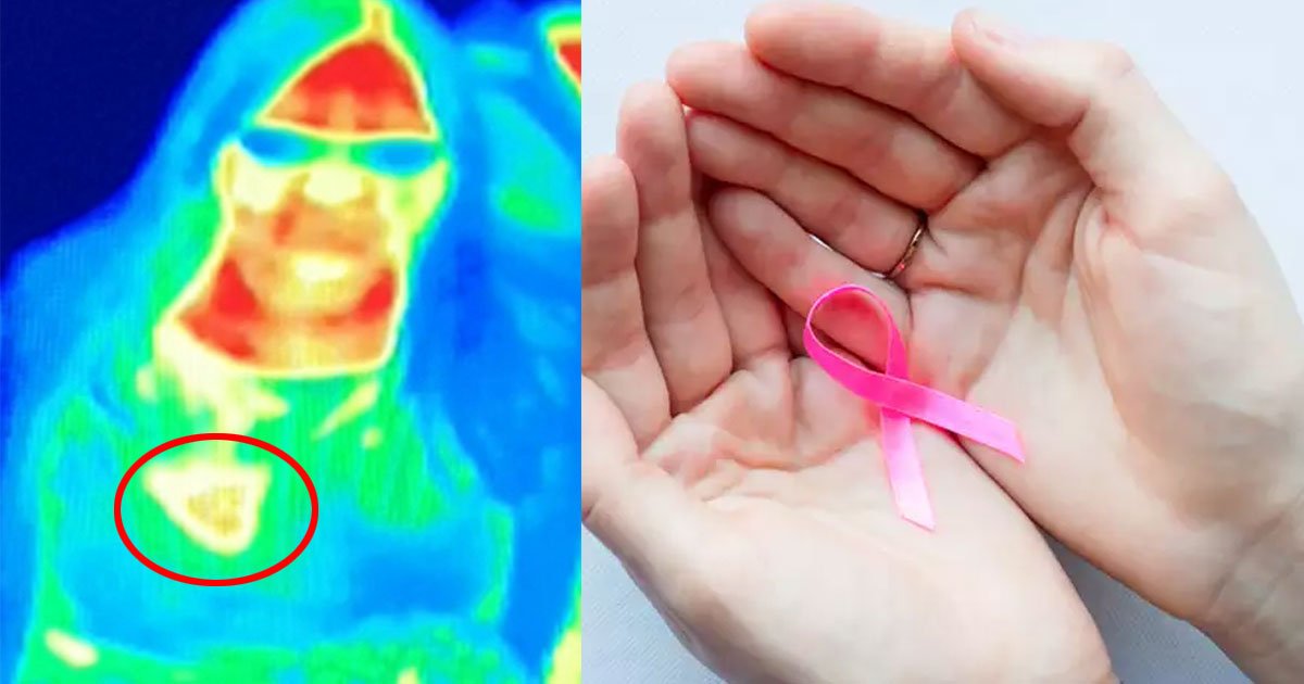 woman discovered she had breast cancer after tourist attractions thermal camera detected a patch.jpg?resize=412,275 - Une femme a découvert qu'elle avait un cancer du sein grâce à la caméra thermique d'un musée