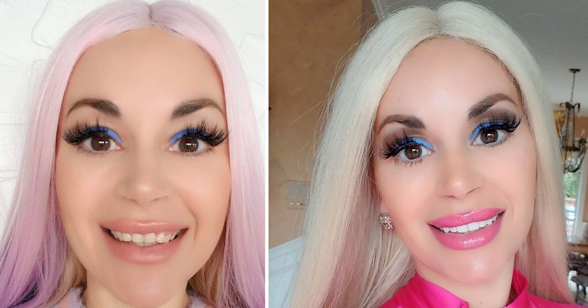 woman never smiled surgery teeth.jpg?resize=412,275 - TV Personality - Who Never Smiled Because She Was Embarrassed By Her Teeth - Is Smiling Like Never Before After $45k Surgery