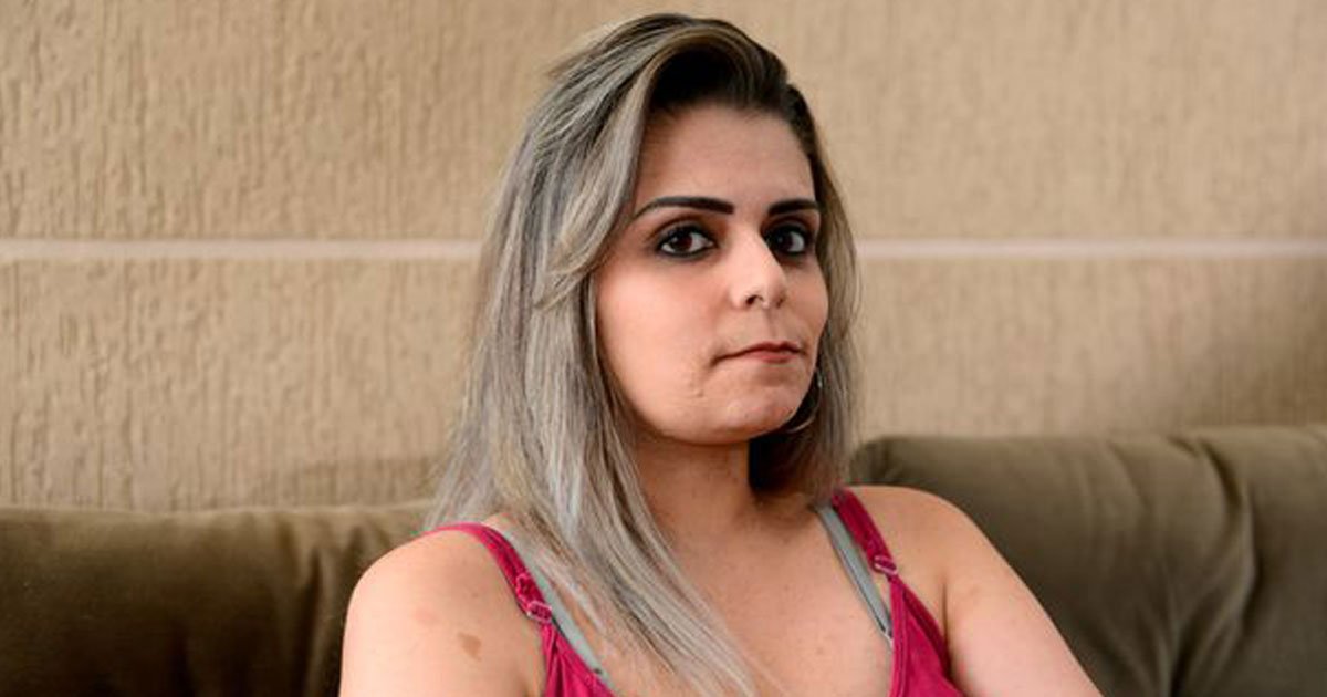woman with 4kg tumors legs.jpg?resize=412,275 - Woman Refuses To Cover Up Her Tumours That Weigh 4kg To Raise Awareness