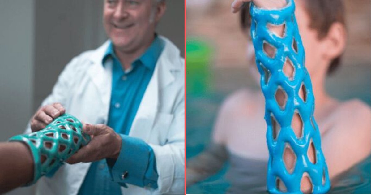 1 25.png?resize=1200,630 - Engineers Have Built Incredible Lightweight, Breathable, and Waterproof Arm Casts Which May Replace Plaster Casts