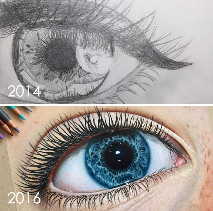 Eye Improvement In 2 Years, 13 To 15 Years Old