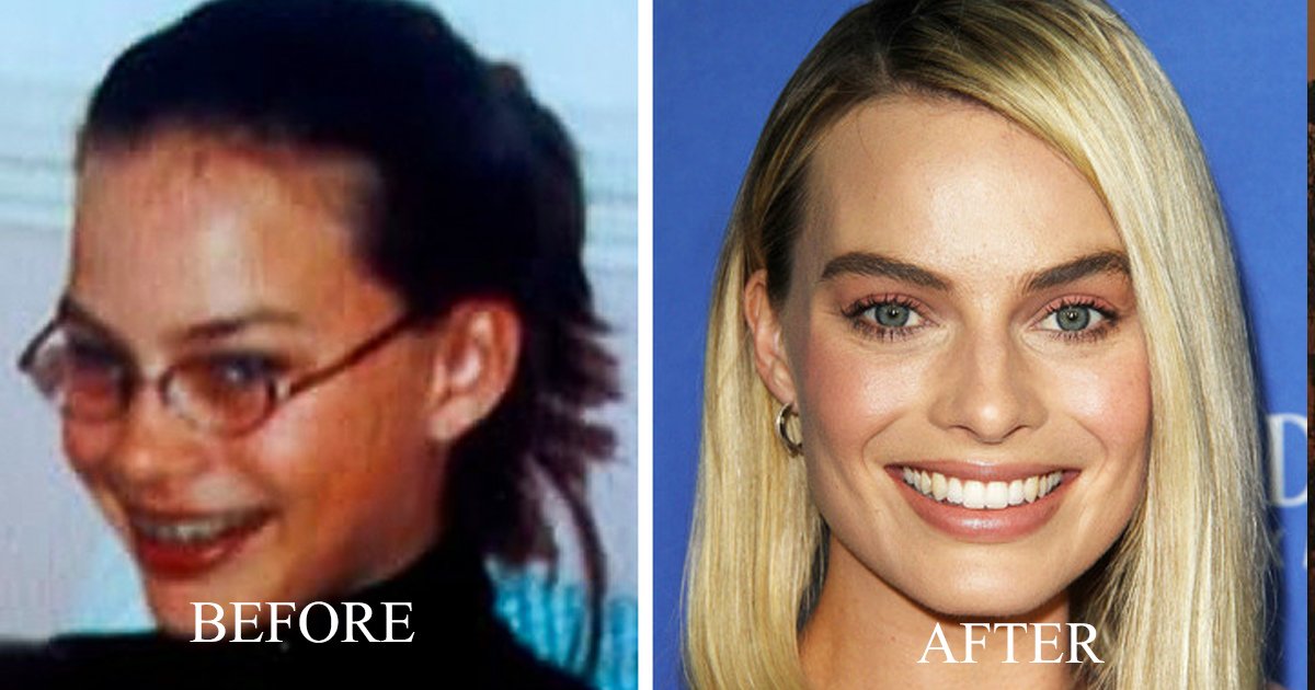 aggag.jpg?resize=412,275 - 9 Celebrities That Were Ugly Ducklings, But are now Idols for Many