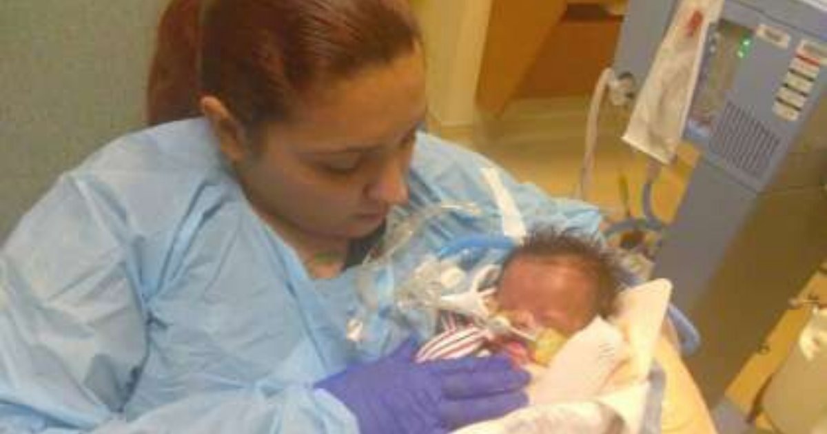 babygray.png?resize=412,275 - Baby Born Without Skin Is Finally Home After Staying In Hospital For 11 Months