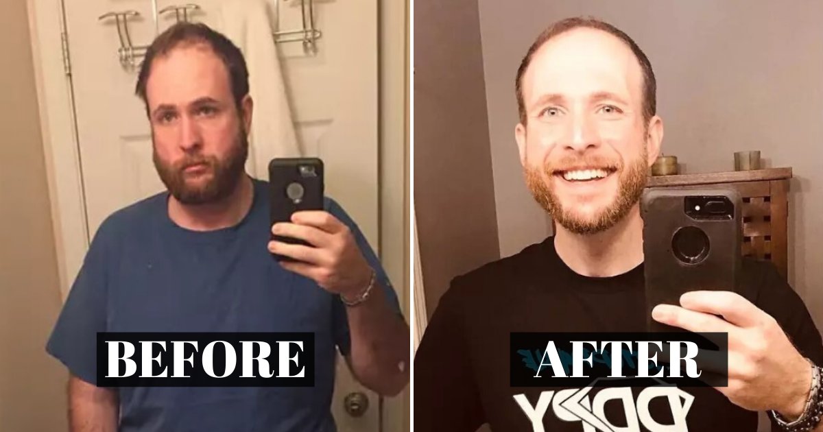 before 1.png?resize=1200,630 - Un homme a partagé des photos de sa transformation après avoir vaincu son alcoolisme