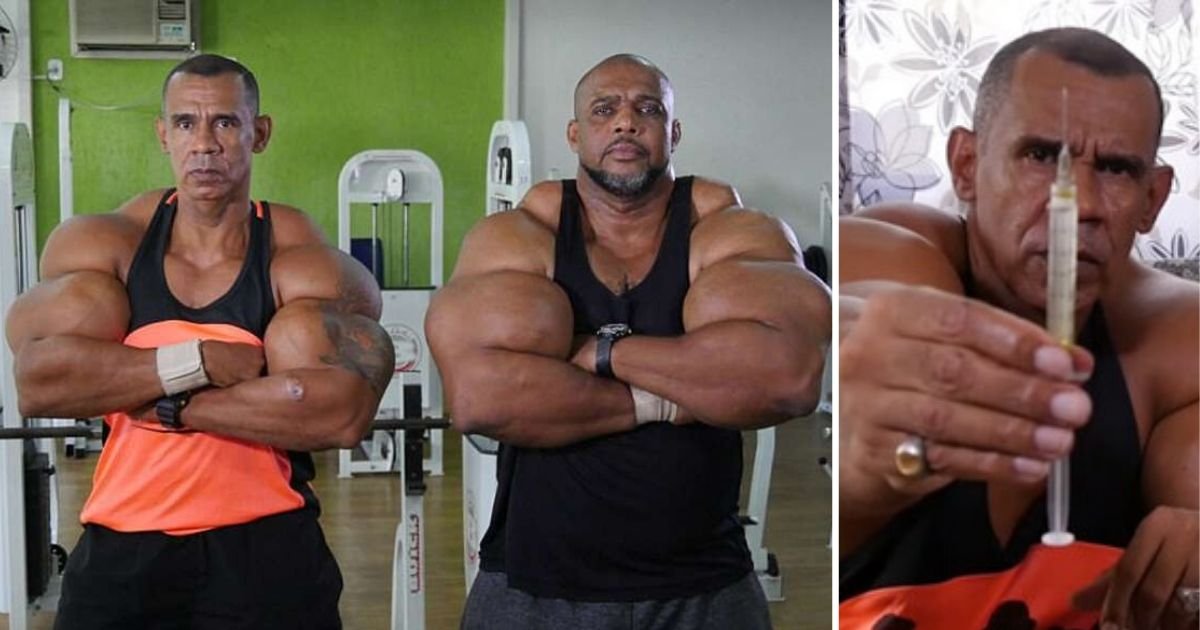 d5 1.jpg?resize=412,275 - Hulk Brothers Risk Their Life After Injecting Dangerous Muscle-Building Chemicals in Their Bodies