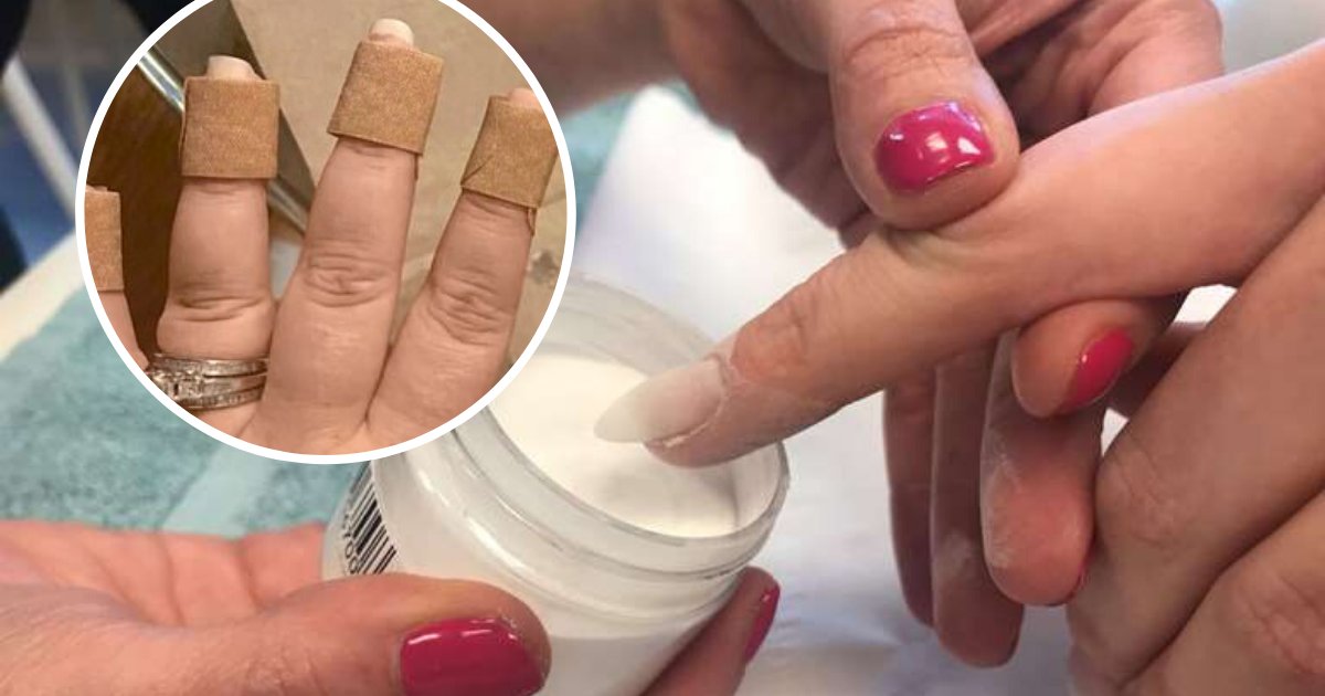 dip3.png?resize=412,275 - Woman Left With Swollen Fingers And Fungal Infection After Dip Powder Manicure