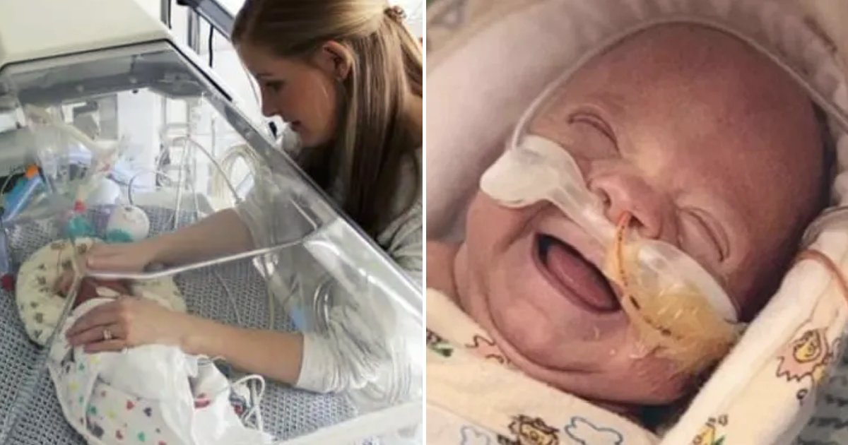finn7.png?resize=412,232 - Premature Baby Was Born Weighing Only ONE Pound, Months Later He Goes Home Healthy And Happy