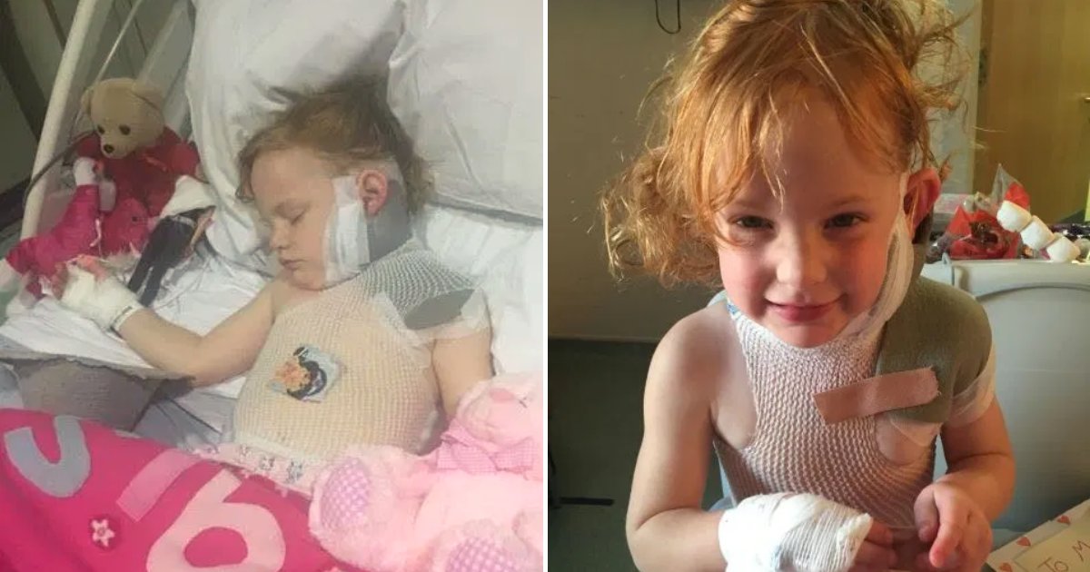roe5.png?resize=412,275 - 'I Was Paralyzed With Terror When A Firework Hit My 4-Year-Old Daughter Leaving Her Scarred For Life'