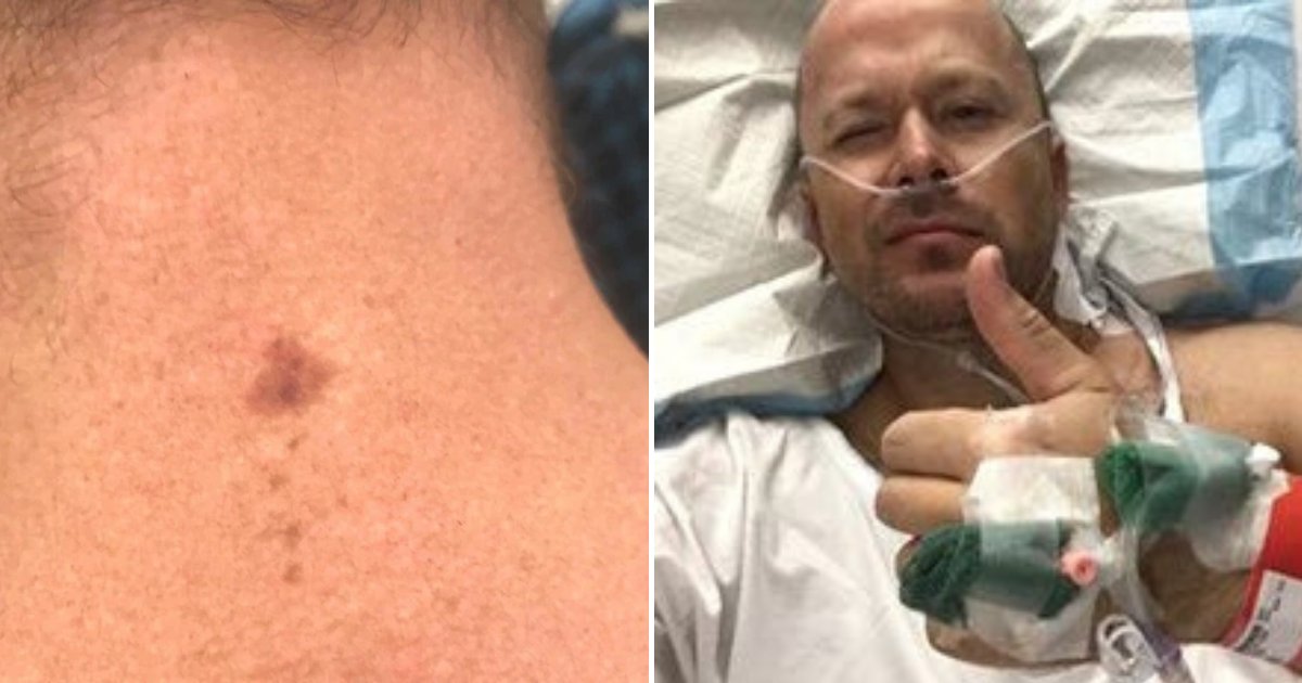 ryan5.png?resize=412,275 - Man Urges Others To Be Vigilant After Spot On His Neck Turned Out To Be Cancer