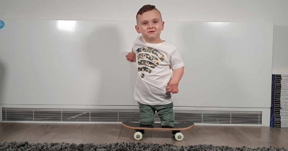 s3 11.jpg?resize=1200,630 - A Young Boy Learned To Skateboard Despite Losing His Fingers And Legs