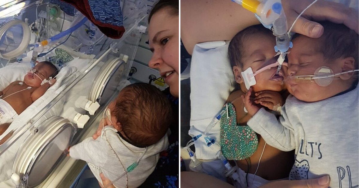 untitled design 62 1.png?resize=412,275 - Premature Baby Saved His Weak Twin Brother By Cuddling And Hugging Him