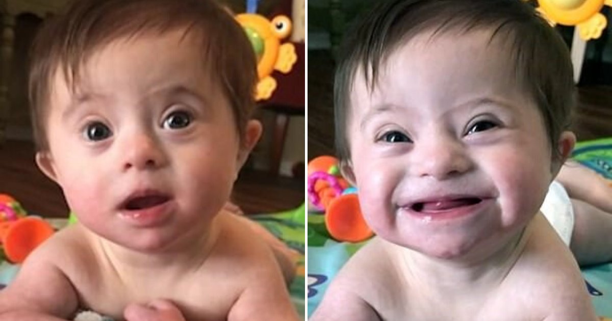 untitled design 82.png?resize=412,275 - 8-Month-Old Girl With Down Syndrome Shared Adorable Smile With Her Adoptive Mother