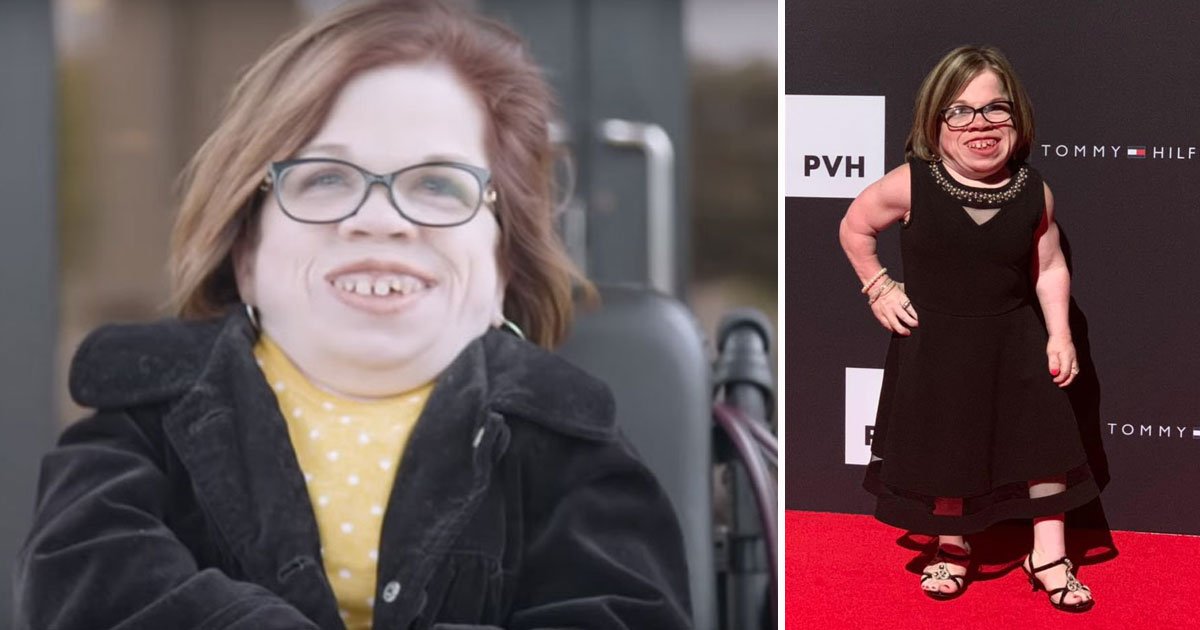 woman only 39 inches tall.jpg?resize=412,275 - 34-Year-Old Woman - Who Is Only 39 Inches Tall Due To Rare Medical Condition - Is Helping People With Similar Condition