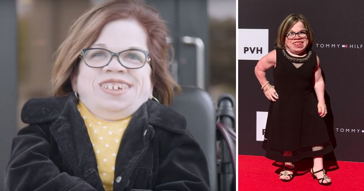 woman only 39 inches tall.jpg?resize=412,232 - 34-Year-Old Woman - Who Is Only 39 Inches Tall Due To Rare Medical Condition - Is Helping People With Similar Condition