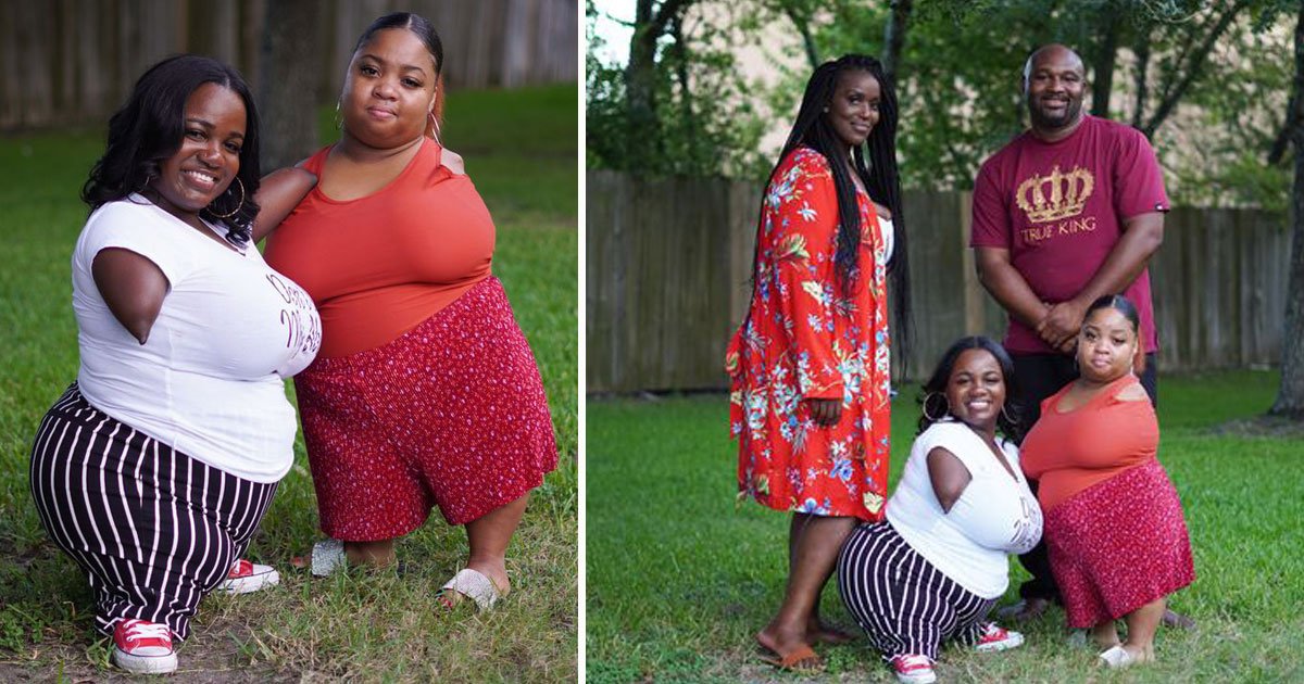 women without limbs.jpg?resize=412,275 - Women Without Limbs Have Become Best Friends After Learning About Each Other’s Life Story