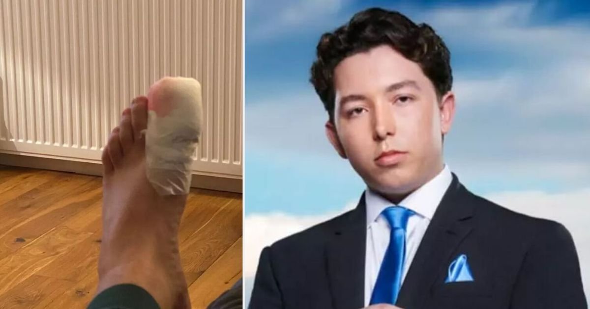 2 5.jpg?resize=412,275 - The Apprentice Contestant Ryan Dropped An Expensive Caviar on His Foot