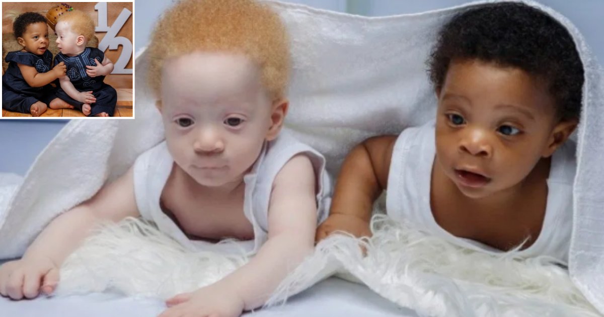 4 14.png?resize=1200,630 - Twin Brothers Were Born Minutes Apart and One Is Albino