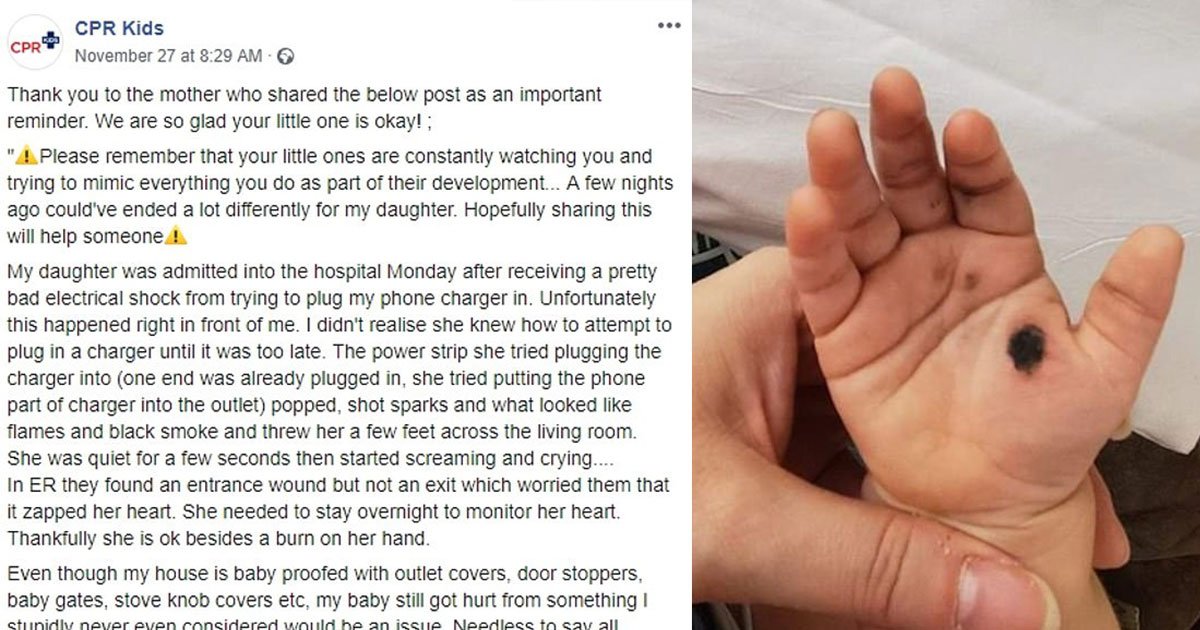 a little girl was electrocuted by a phone charger and admitted to the hospital.jpg?resize=1200,630 - A Little Girl Was Admitted To The Hospital After Getting A Burn On Her Hand While Trying To Plug A Charger