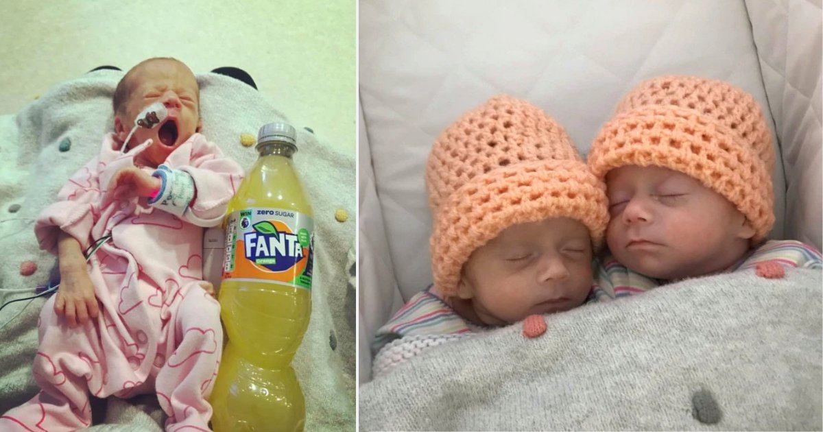 d1.png?resize=1200,630 - These Twin Sisters Are Born As The Size Of A Fanta Bottle
