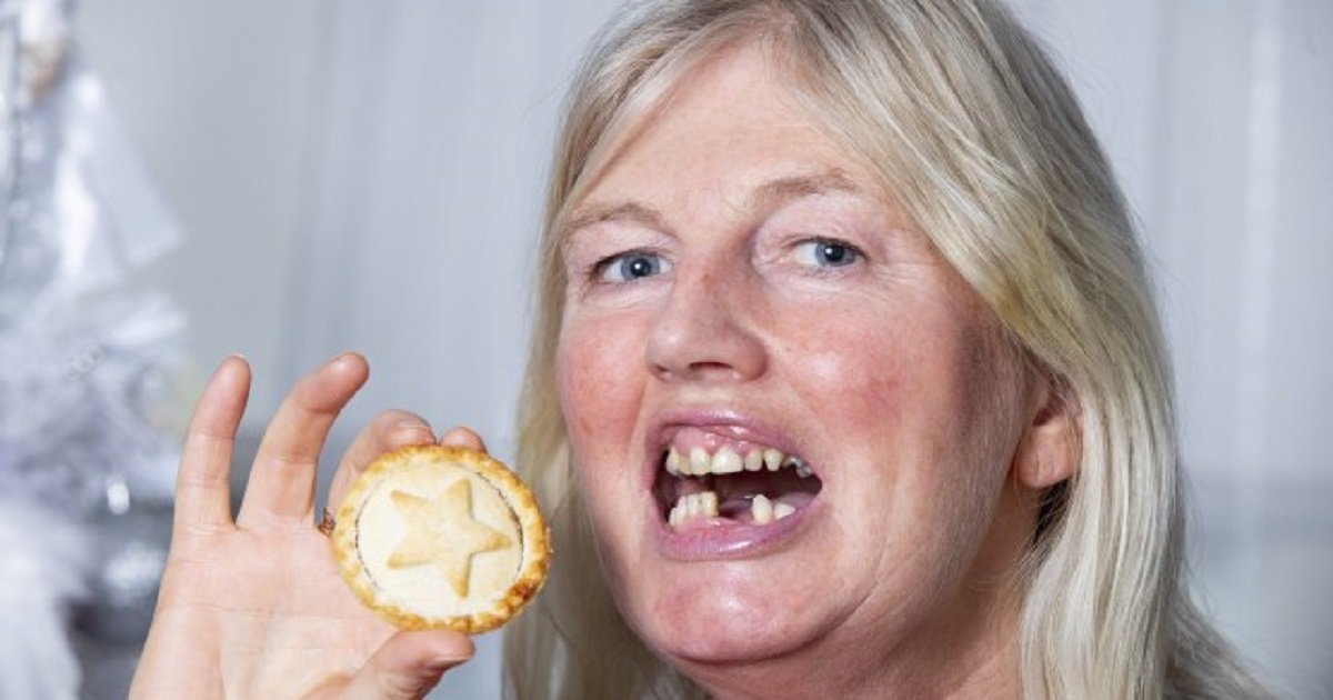 d3 2.jpg?resize=412,275 - Woman Accidentally Swallowed Her Dentures While Eating A Mince Pie