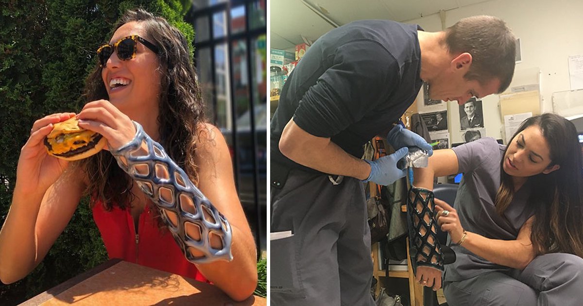 dgsgsgs.jpg?fit=1024%2C538&ssl=1&strip=all - Revolutionary New Arm Cast Is Breathable, Water-proof And Itch-free
