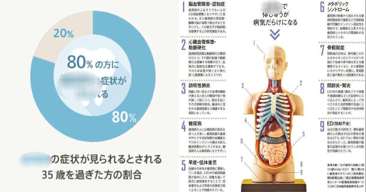 e696b0e8a68fe38397e383ade382b8e382a7e382afe38388 6 3.png?resize=412,275 - 日本人の8割が"OO病"って？命にかかわる重大な疾患にも…