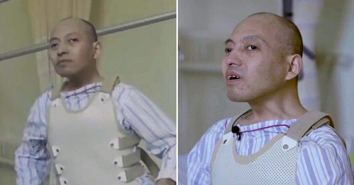 li6.png?resize=412,275 - 46-Year-Old Man Finally Stands Straight After Being Folded For 28 Years