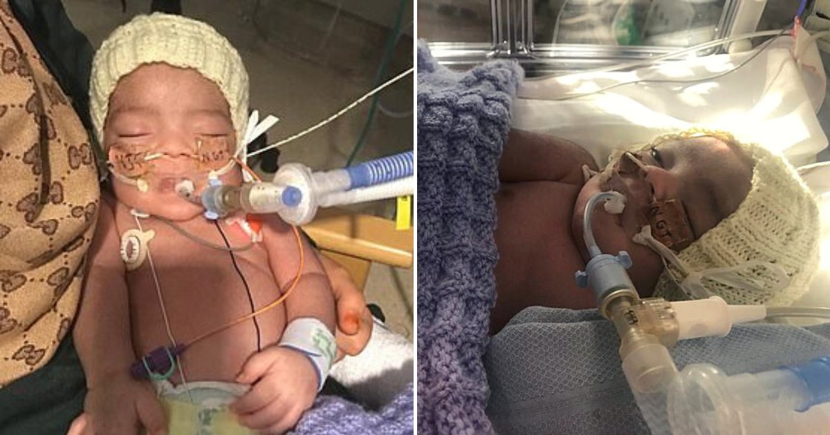 midrar5.png?resize=412,275 - 3-Month-Old Baby Fighting For Life Received A Reprieve