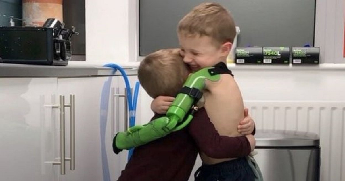p3 3.jpg?resize=1200,630 - 5-Year-Old Boy Hugged His Brother The Moment He Received His Prosthetic Limb