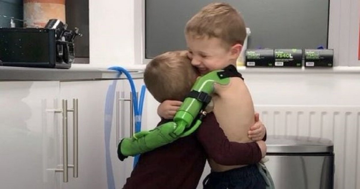 p3 3.jpg?resize=412,275 - 5-Year-Old Boy Hugged His Brother The Moment He Received His Prosthetic Limb