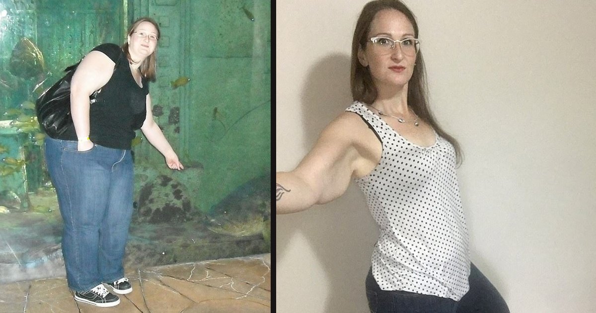 untitled 1 24.jpg?resize=412,275 - A Mother With Lipoedema Needs To Raise $147,000 To Drain 20 Liters Of Fat From Her Limbs