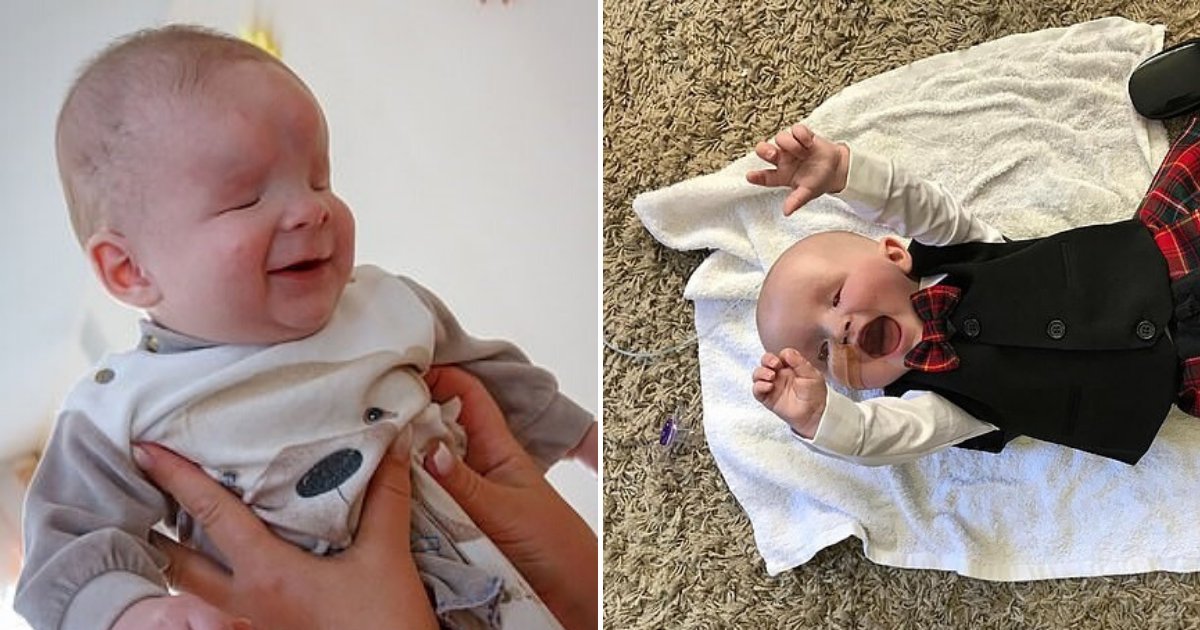 untitled design 8 4.png?fit=1024%2C538&ssl=1&strip=all - Baby Boy Born With No Eyes Has Been Adopted By Loving Parents