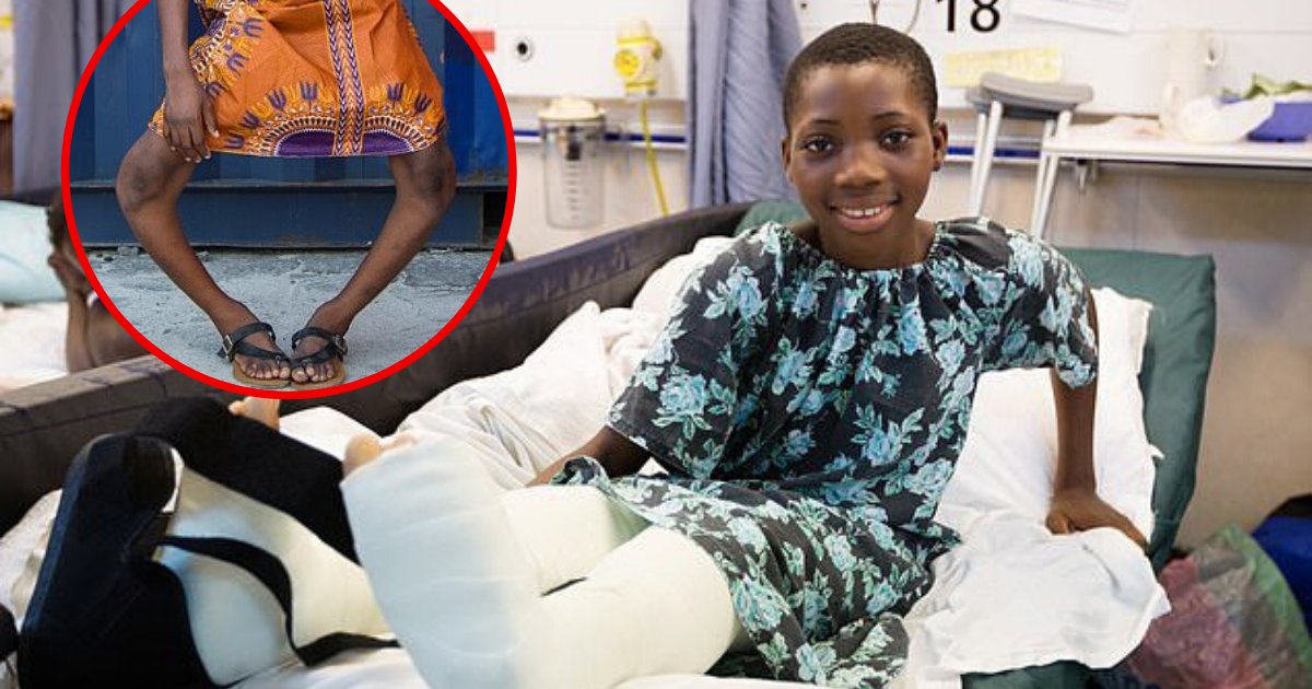 valerie6.png?resize=412,275 - Une fille aux jambes sévèrement arquées a subi une chirurgie qui a changé sa vie grâce à une ONG